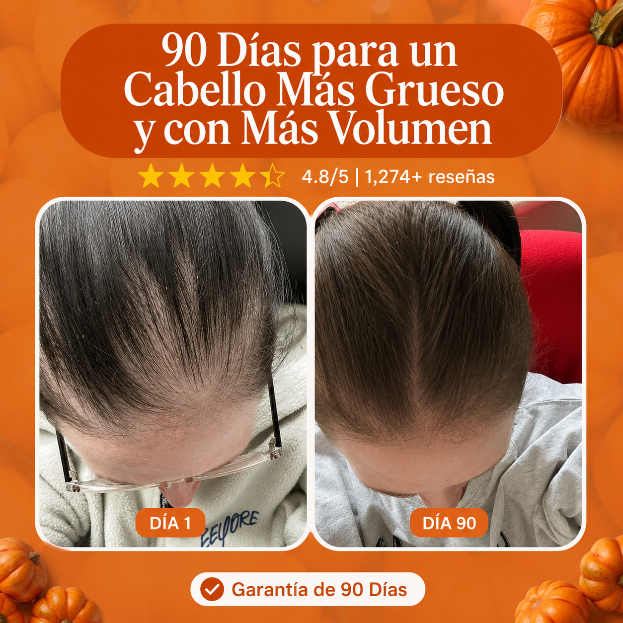Folivara™ — Cápsulas de aceite de semilla de calabaza para un cabello más fuerte y abundante