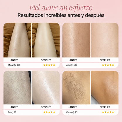 SmoothBikini™ — La rasuradora femenina para una zona íntima suave y sin irritación