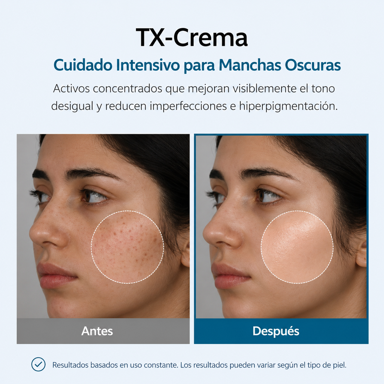 MelaNova™ — Tratamiento Coreano Avanzado para Manchas y Melasma