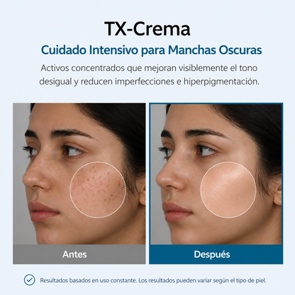 MelaNova™ — Tratamiento Coreano Avanzado para Manchas y Melasma